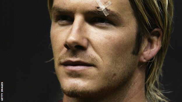 Beckham e o machucado após a discussão com Ferguson.